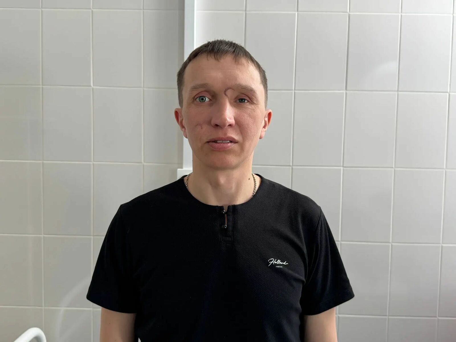 В Башкортостане ветерану СВО провели цикл пластических операций